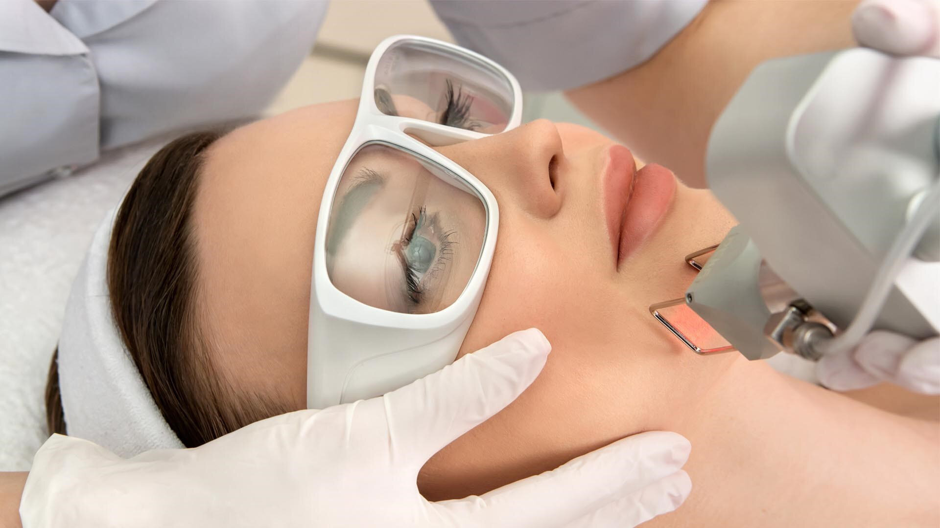 yuze-buz-lazer