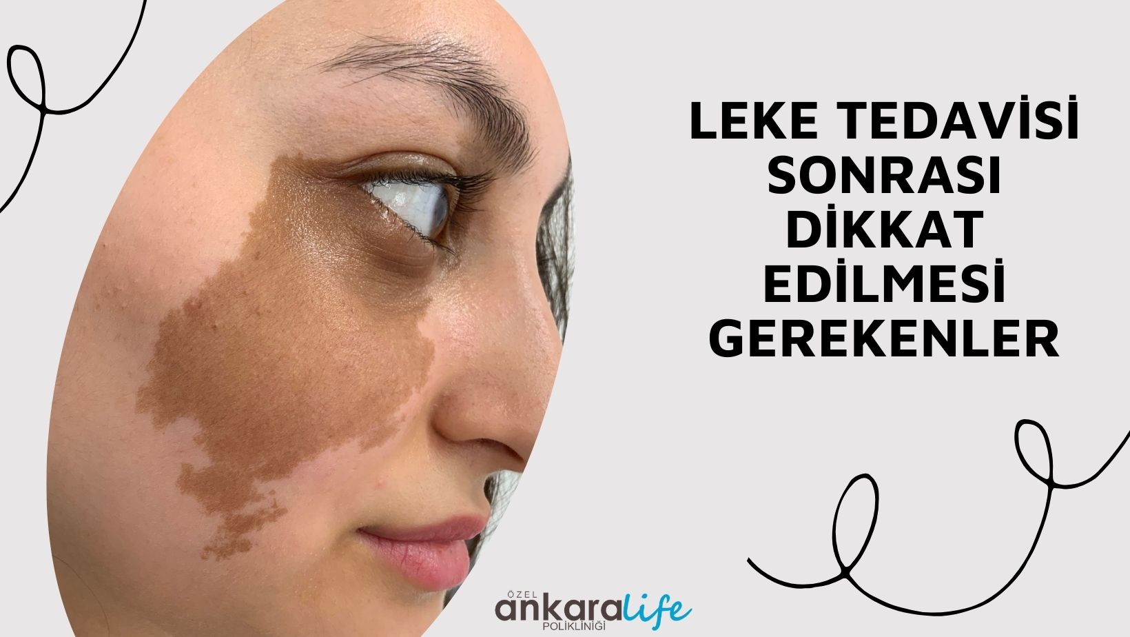 Things to Consider After Spot Treatment
