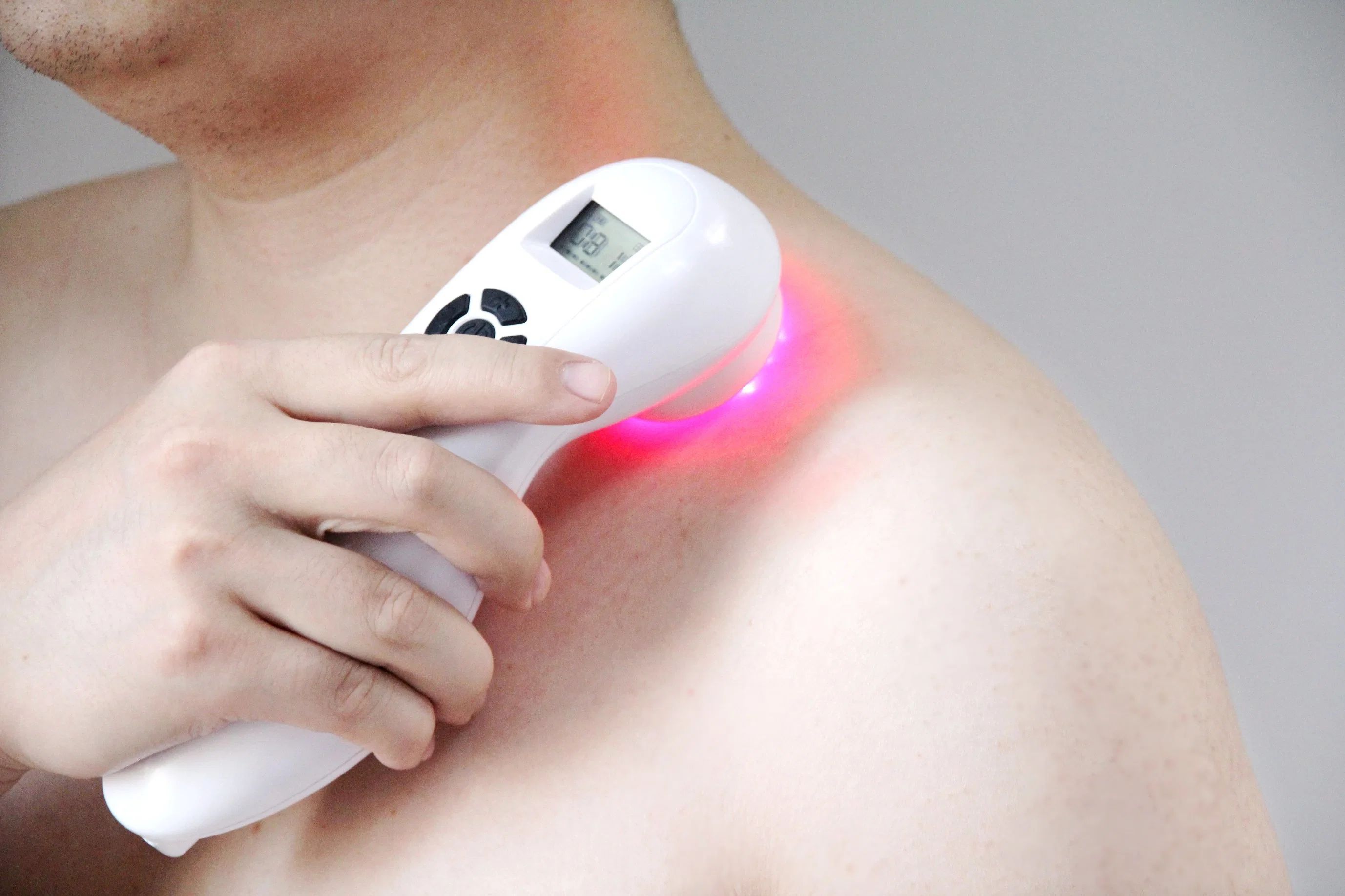 becker-nevus-lazer-tedavisi-fiyatlari