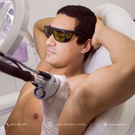 erkek-genital-bolge-lazer-epilasyon-eksi