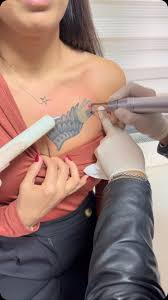 picosure-dovme-silme-cihazi