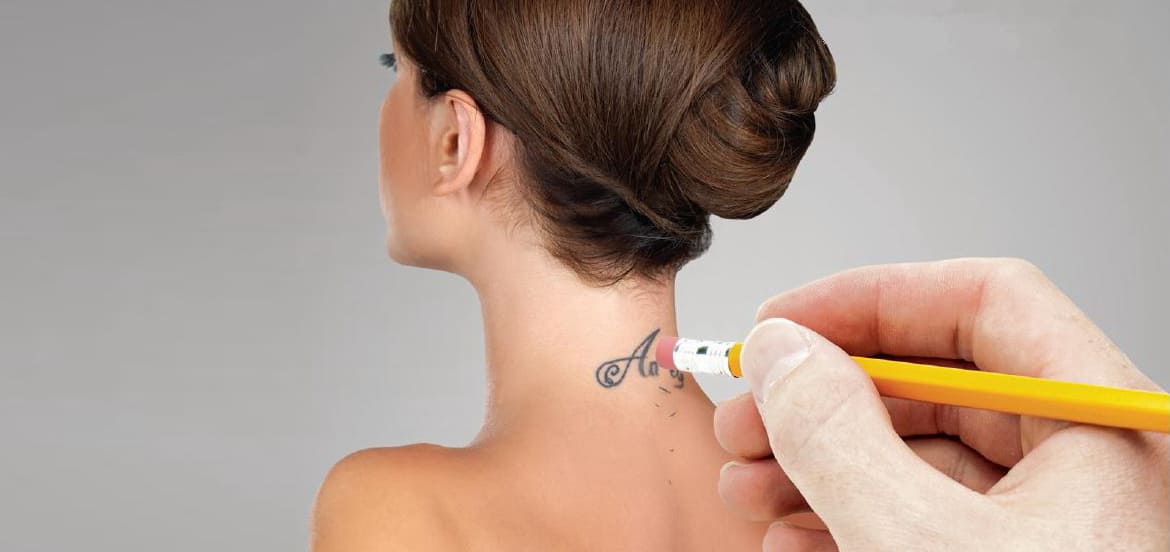 dovme-silme-picosure-yorumlar