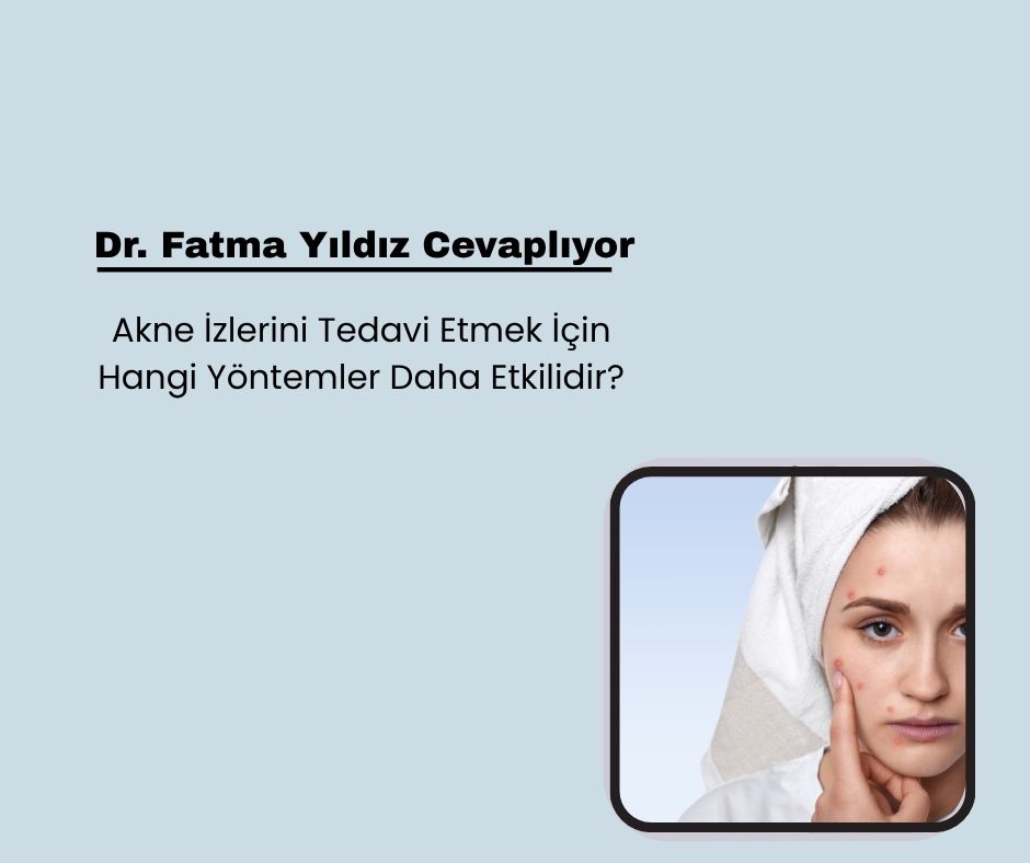 Akne İzlerini Tedavi Etmek İçin Hangi Yöntemler Daha Etkilidir?