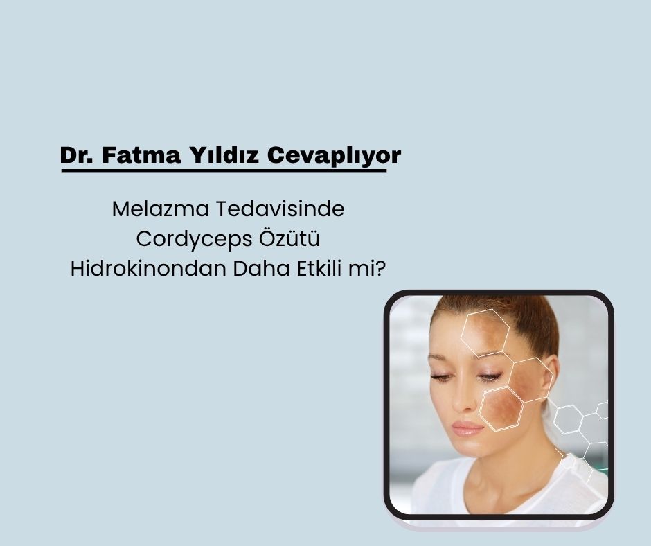 Melazma Tedavisinde Cordyceps Özütü Hidrokinondan Daha Etkili mi?