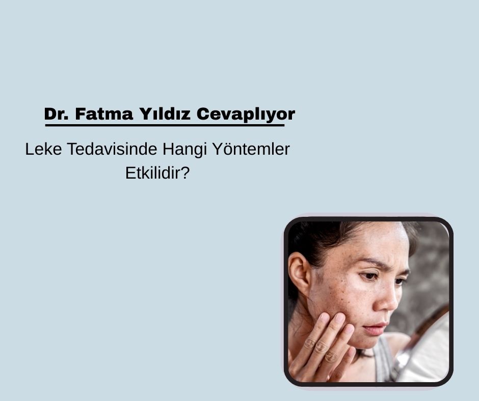 Leke Tedavisinde Hangi Yöntemler Etkilidir?