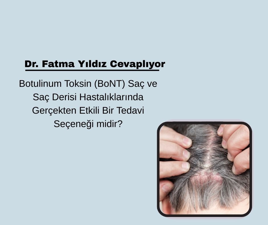 Botulinum Toksin (BoNT) Saç ve Saç Derisi Hastalıklarında Gerçekten Etkili Bir Tedavi Seçeneği midir?