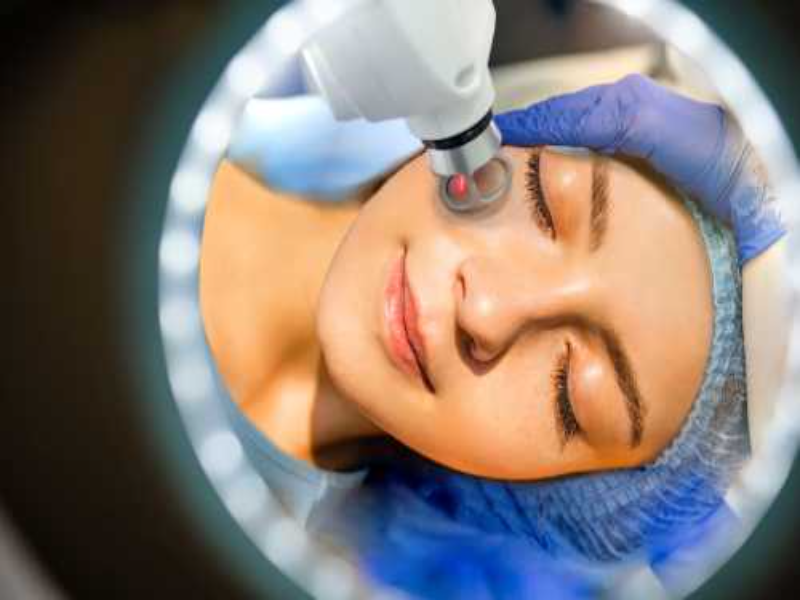 baby face beauty thulium lazer fiyat