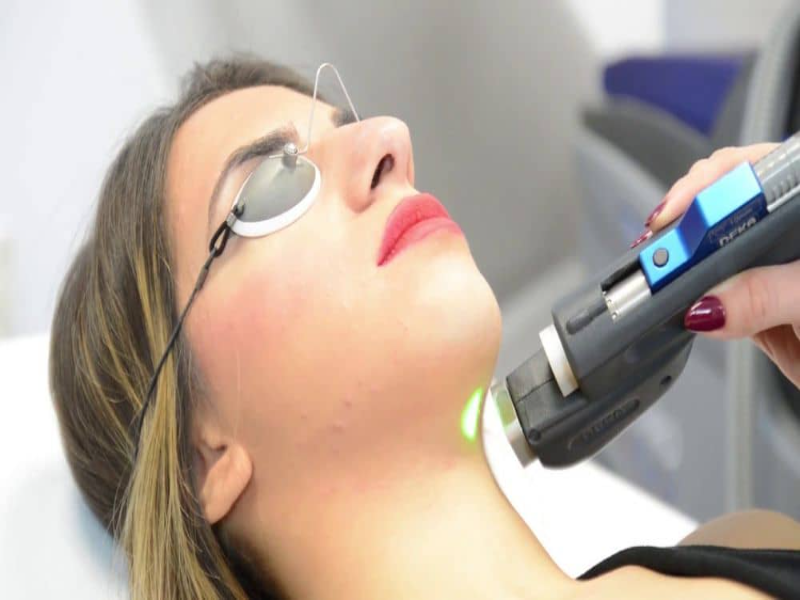thulium fraksiyonel lazer