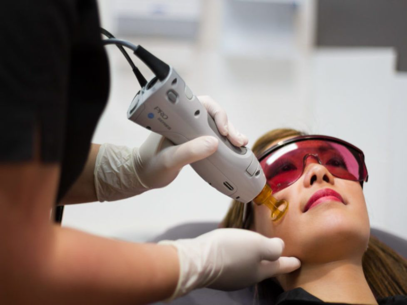 thulium lazer sivilce