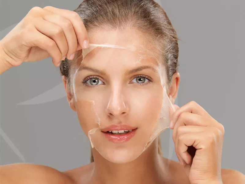 peeling leke tedavisi kac seansta fark olusturabilir