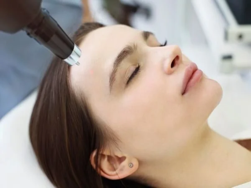 thulium lazer leke tedavisi hakkinda dogru bilinen yanlislar